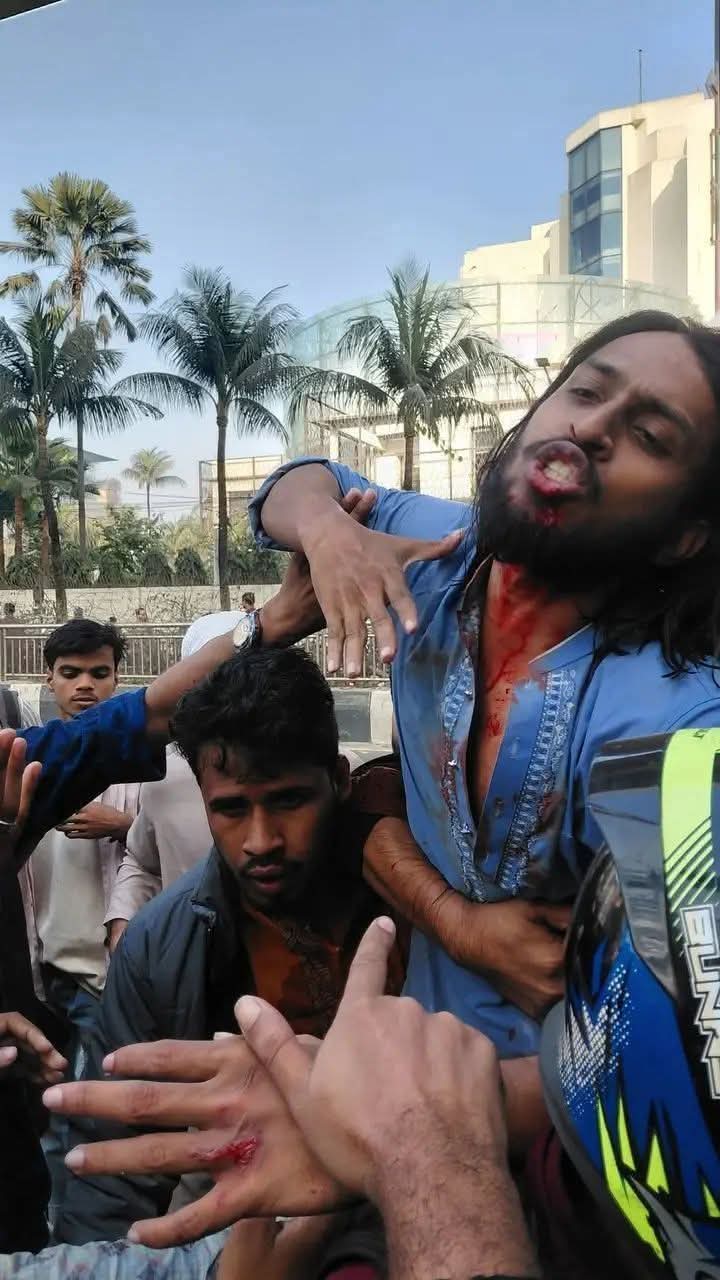 শাহবাগে পুলিশের লাঠিচার্জে গুরুতর আহত রাকসুর জিএস সালাউদ্দিন আম্মার